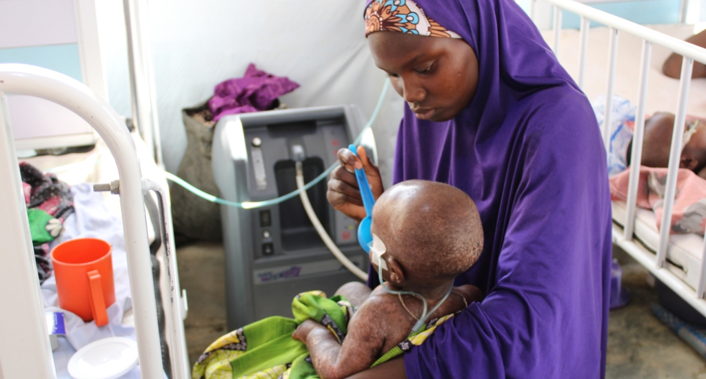 Un enfant sous assistance respiratoire dans le service des cas critiques de rougeole de l'hôpital général d'Anka géré par MSF, 2021